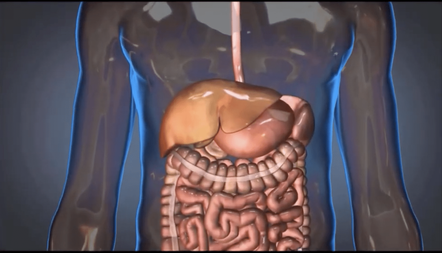 Waltham biotech’s injectable foam saves first life in clinical trial